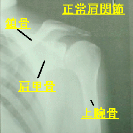 肩