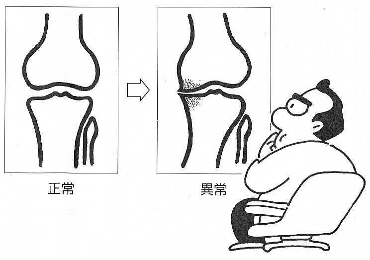 knee