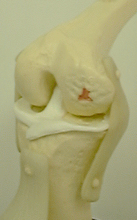 knee
